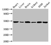 Western Blot<br />
 Positive WB detected in: Mouse heart tissue, Mouse liver tissue, Mouse brain tissue, Mouse kidney tissue, A549 whole cell lysate, Jurkat whole cell lysate<br />
 All lanes: ENO2 antibody at 1.5µg/ml<br />
 Secondary<br />
 Goat polyclonal to rabbit IgG at 1/10000 dilution<br />
 Predicted band size: 48, 43 kDa<br />
 Observed band size: 48 kDa<br />