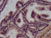 IHC image of CSB-PA09794A0Rb diluted at 1:200 and staining in paraffin-embedded human prostate tissue performed on a Leica BondTM system. After dewaxing and hydration, antigen retrieval was mediated by high pressure in a citrate buffer (pH 6.0) . Section was blocked with 10% normal goat serum 30min at RT. Then primary antibody (1% BSA) was incubated at 4°C overnight. The primary is detected by a biotinylated secondary antibody and visualized using an HRP conjugated SP system.