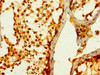 Immunohistochemistry of paraffin-embedded human testis tissue using CSB-PA09889A0Rb at dilution of 1:100