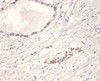 Immunohistochemistry of paraffin-embedded human prostate tissue using CSB-PA09929A0Rb at dilution of 1:100