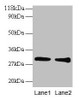 Western blot<br />
 All lanes: GSTP1 antibody at 2µg/ml<br />
 Lane 1: EC109 whole cell lysate<br />
 Lane 2: 293T whole cell lysate<br />
 Secondary<br />
 Goat polyclonal to rabbit IgG at 1/15000 dilution<br />
 Predicted band size: 24 kDa<br />
 Observed band size: 30 kDa<br />