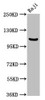 Western Blot<br />
 Positive WB detected in: Raji whole cell lysate<br />
 All lanes: NFKB1 antibody at 3.75µg/ml<br />
 Secondary<br />
 Goat polyclonal to rabbit IgG at 1/50000 dilution<br />
 Predicted band size: 106, 86 kDa<br />
 Observed band size: 106 kDa<br />