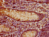 IHC image of CSB-PA10484A0Rb diluted at 1:80 and staining in paraffin-embedded human appendix tissue performed on a Leica BondTM system. After dewaxing and hydration, antigen retrieval was mediated by high pressure in a citrate buffer (pH 6.0) . Section was blocked with 10% normal goat serum 30min at RT. Then primary antibody (1% BSA) was incubated at 4°C overnight. The primary is detected by a biotinylated secondary antibody and visualized using an HRP conjugated SP system.