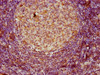 IHC image of CSB-PA10484A0Rb diluted at 1:80 and staining in paraffin-embedded human lymph node tissue performed on a Leica BondTM system. After dewaxing and hydration, antigen retrieval was mediated by high pressure in a citrate buffer (pH 6.0) . Section was blocked with 10% normal goat serum 30min at RT. Then primary antibody (1% BSA) was incubated at 4°C overnight. The primary is detected by a biotinylated secondary antibody and visualized using an HRP conjugated SP system.