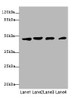 Western blot<br /> 
 All lanes: KRT18 antibody at 12µg/ml<br />
 Lane 1: A431 whole cell lysate<br />
 Lane 2: Hela whole cell lysate<br />
 Lane 3: Jurkat whole cell lysate<br />
 Lane 4: Zebrafish lysate<br />
 Secondary<br />
 Goat polyclonal to rabbit IgG at 1/10000 dilution<br />
 Predicted band size: 49 kDa<br />
 Observed band size: 49 kDa<br />