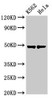 Western Blot<br />
 Positive WB detected in: K562 whole cell lysate, Hela whole cell lysate<br />
 All lanes: KRT18 antibody at 3µg/ml<br />
 Secondary<br />
 Goat polyclonal to rabbit IgG at 1/50000 dilution<br />
 Predicted band size: 49 kDa<br />
 Observed band size: 49 kDa<br />