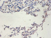 Immunohistochemistry of paraffin-embedded human lungs tissue using CSB-PA10669A0Rb at dilution of 1:100