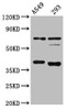 Western Blot<br />
 Positive WB detected in: A549 whole cell lysate, 293 whole cell lysate<br />
 All lanes: CTSS antibody at 1:4000<br />
 Secondary<br />
 Goat polyclonal to rabbit IgG at 1/50000 dilution<br />
 Predicted band size: 38, 32 kDa<br />
 Observed band size: 38 kDa<br />