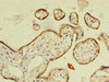 Immunohistochemistry of paraffin-embedded human placenta tissue using CSB-PA10759A0Rb at dilution of 1:100