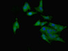 Immunofluorescent analysis of Hela cells using CSB-PA10759A0Rb at dilution of 1:100 and Alexa Fluor 488-congugated AffiniPure Goat Anti-Rabbit IgG (H+L)