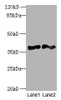 Western blot<br />
 All lanes: DNAJB4 antibody at 2µg/ml<br />
 Lane 1: Hela whole cell lysate<br />
 Lane 2: Mouse heart tissue<br />
 Secondary<br />
 Goat polyclonal to rabbit IgG at 1/10000 dilution<br />
 Predicted band size: 38 kDa<br />
 Observed band size: 38 kDa<br />