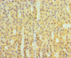Immunohistochemistry of paraffin-embedded human adrenal gland tissue using CSB-PA11049A0Rb at dilution of 1:100