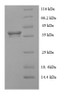 (Tris-Glycine gel) Discontinuous SDS-PAGE (reduced) with 5% enrichment gel and 15% separation gel.