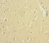 Immunohistochemistry of paraffin-embedded human brain tissue using CSB-PA11407A0Rb at dilution of 1:100