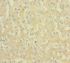 Immunohistochemistry of paraffin-embedded human liver tissue using CSB-PA11407A0Rb at dilution of 1:100