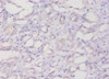 Immunohistochemistry of paraffin-embedded human kidney tissue using CSB-PA11409A0Rb at dilution of 1:20