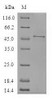 (Tris-Glycine gel) Discontinuous SDS-PAGE (reduced) with 5% enrichment gel and 15% separation gel.