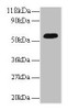 Western blot<br />
 All lanes: ICA1 antibody at 2µg/ml + A549 whole cell lysate<br />
 Secondary<br />
 Goat polyclonal to rabbit IgG at 1/10000 dilution<br />
 Predicted band size: 55, 58 kDa<br />
 Observed band size: 55 kDa<br />