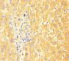 Immunohistochemistry of paraffin-embedded human liver tissue using CSB-PA12197A0Rb at dilution of 1:100