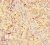 Immunohistochemistry of paraffin-embedded human adrenal gland tissue using CSB-PA12379A0Rb at dilution of 1:100