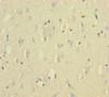 Immunohistochemistry of paraffin-embedded human brain tissue using CSB-PA12779A0Rb at dilution of 1:100