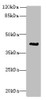 Western blot<br />
 All lanes: ACTG2 antibody at 3µg/ml + CEM whole cell lysate<br />
 Secondary<br />
 Goat polyclonal to rabbit IgG at 1/10000 dilution<br />
 Predicted band size: 42, 38 kDa<br />
 Observed band size: 42 kDa<br />