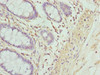 Immunohistochemistry of paraffin-embedded human colon tissue using CSB-PA12799A0Rb at dilution of 1:100