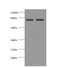 Western blot<br />
 All lanes: CDH12 antibody at 2µg/ml<br />
 Lane 1: EC109 whole cell lysate<br />
 Lane 2: 293T whole cell lysate<br />
 Secondary<br />
 Goat polyclonal to rabbit IgG at 1/10000 dilution<br />
 Predicted band size: 89, 85 kDa<br />
 Observed band size: 85 kDa<br />