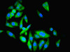 Immunofluorescent analysis of Hela cells using CSB-PA13169A0Rb at dilution of 1:100 and Alexa Fluor 488-congugated AffiniPure Goat Anti-Rabbit IgG (H+L)