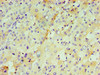 Immunohistochemistry of paraffin-embedded human liver tissue using CSB-PA13249A0Rb at dilution of 1:100