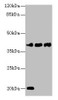 Western blot<br />
 All lanes: STEAP1 antibody at 1µg/ml<br />
 Lane 1: U87 whole cell lysate<br />
 Lane 2: A431 whole cell lysate<br />
 Lane 3: A549 whole cell lysate<br />
 Secondary<br />
 Goat polyclonal to rabbit IgG at 1/10000 dilution<br />
 Predicted band size: 40 kDa<br />
 Observed band size: 40 kDa<br />