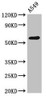 Western Blot<br />
 Positive WB detected in: A549 whole cell lysate<br />
 All lanes: PODXL antibody at 2.6µg/ml<br />
 Secondary<br />
 Goat polyclonal to rabbit IgG at 1/50000 dilution<br />
 Predicted band size: 59, 56 kDa<br />
 Observed band size: 59 kDa<br />