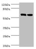 Western blot<br />
 All lanes: TROVE2 antibody at 2µg/ml<br />
 Lane 1: Hela whole cell lysate<br />
 Lane 2: 293T whole cell lysate<br />
 Secondary<br />
 Goat polyclonal to rabbit IgG at 1/10000 dilution<br />
 Predicted band size: 61, 24, 59, 60 kDa<br />
 Observed band size: 61 kDa<br />