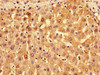 Immunohistochemistry of paraffin-embedded human liver tissue using CSB-PA13749A0Rb at dilution of 1:100