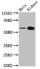 Western Blot<br />
 Positive WB detected in: Hela whole cell lysate, Rat kidney tissue<br />
 All lanes: TROVE2 antibody at 3.4µg/ml<br />
 Secondary<br />
 Goat polyclonal to rabbit IgG at 1/50000 dilution<br />
 Predicted band size: 61, 24, 59, 60 kDa<br />
 Observed band size: 61 kDa<br />