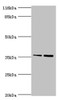 Western blot<br />
 All lanes: CFHR2 antibody at 2µg/ml<br />
 Lane 1: Hela whole cell lysate<br />
 Lane 2: 293T whole cell lysate<br />
 Secondary<br />
 Goat polyclonal to rabbit IgG at 1/10000 dilution<br />
 Predicted band size: 31, 28 kDa<br />
 Observed band size: 36 kDa<br />