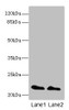 Western blot<br />
 All lanes: KRAS antibody at 2µg/ml<br />
 Lane 1: Mouse brain tissue<br />
 Lane 2: Mouse kidney tissue<br />
 Secondary<br />
 Goat polyclonal to rabbit IgG at 1/10000 dilution<br />
 Predicted band size: 22 kDa<br />
 Observed band size: 22 kDa<br />