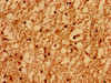 Immunohistochemistry of paraffin-embedded human brain tissue using CSB-PA14129A0Rb at dilution of 1:100