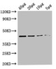 Western Blot<br />
 Positive WB detected in: Rosseta bacteria lysate at 40μg, 20μg, 10μg, 5μg<br />
 All lanes: metC antibody at 0.36µg/ml<br />
 Secondary<br />
 Goat polyclonal to rabbit IgG at 1/50000 dilution<br />
 Predicted band size: 44 kDa<br />
 Observed band size: 44 kDa<br />