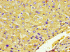IHC image of CSB-PA14609A0Rb diluted at 1:600 and staining in paraffin-embedded human liver tissue performed on a Leica BondTM system. After dewaxing and hydration, antigen retrieval was mediated by high pressure in a citrate buffer (pH 6.0) . Section was blocked with 10% normal goat serum 30min at RT. Then primary antibody (1% BSA) was incubated at 4°C overnight. The primary is detected by a biotinylated secondary antibody and visualized using an HRP conjugated ABC system.