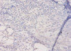 Immunohistochemistry of paraffin-embedded human prostate tissue using CSB-PA14839A0Rb at dilution of 1:50