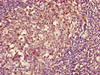 Immunohistochemistry of paraffin-embedded human tonsil tissue using CSB-PA14839D0Rb at dilution of 1:100