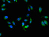 Immunofluorescent analysis of Hela cells using CSB-PA15099A0Rb at dilution of 1:100