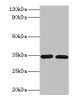 Western blot<br />
 All lanes: CASP7 antibody at 2µg/ml<br />
 Lane 1: A549 whole cell lysate<br />
 Lane 2: HGC-27 whole cell lysate<br />
 Secondary<br />
 Goat polyclonal to rabbit IgG at 1/10000 dilution<br />
 Predicted band size: 35, 29, 38, 32 kDa<br />
 Observed band size: 35 kDa<br />