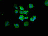 Immunofluorescence staining of MCF-7 cells with CSB-PA15479A0Rb at 1:66, counter-stained with DAPI. The cells were fixed in 4% formaldehyde, permeabilized using 0.2% Triton X-100 and blocked in 10% normal Goat Serum. The cells were then incubated with the antibody overnight at 4°C. The secondary antibody was Alexa Fluor 488-congugated AffiniPure Goat Anti-Rabbit IgG (H+L) .