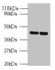Western blot<br />
 All lanes: Vasopressin V1b receptor antibody at 2µg/ml<br />
 Lane 1: EC109 whole cell lysate<br />
 Lane 2: 293T whole cell lysate<br />
 Secondary<br />
 Goat polyclonal to rabbit IgG at 1/10000 dilution<br />
 Predicted band size: 47 kDa<br />
 Observed band size: 47 kDa<br />