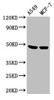 Western Blot<br />
 Positive WB detected in: A549 whole cell lysate, MCF-7 whole cell lysate<br />
 All lanes: LOX antibody at 3.6µg/ml<br />
 Secondary<br />
 Goat polyclonal to rabbit IgG at 1/50000 dilution<br />
 Predicted band size: 47 kDa<br />
 Observed band size: 47 kDa<br />