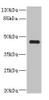 Western blot<br />
 All lanes: Ren2 antibody at 2µg/ml + MCF-7 whole cell lysate<br />
 Secondary<br />
 Goat polyclonal to rabbit IgG at 1/10000 dilution<br />
 Predicted band size: 45 kDa<br />
 Observed band size: 45 kDa<br />
