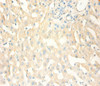 Immunohistochemistry of paraffin-embedded human liver tissue using CSB-PA17374A0Rb at dilution of 1:100