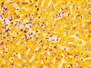 Immunohistochemistry of paraffin-embedded human liver tissue using CSB-PA17469A0Rb at dilution of 1:100